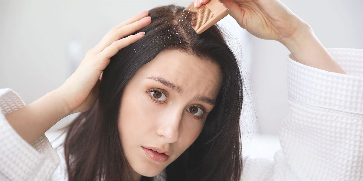 consigli shampoo purificante antiforfora secca migliore per capelli